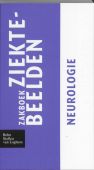 Voorkant - Zakboek ziektebeelden Neurologie