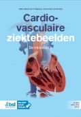 Voorkant - Cardiovasculaire ziektebeelden